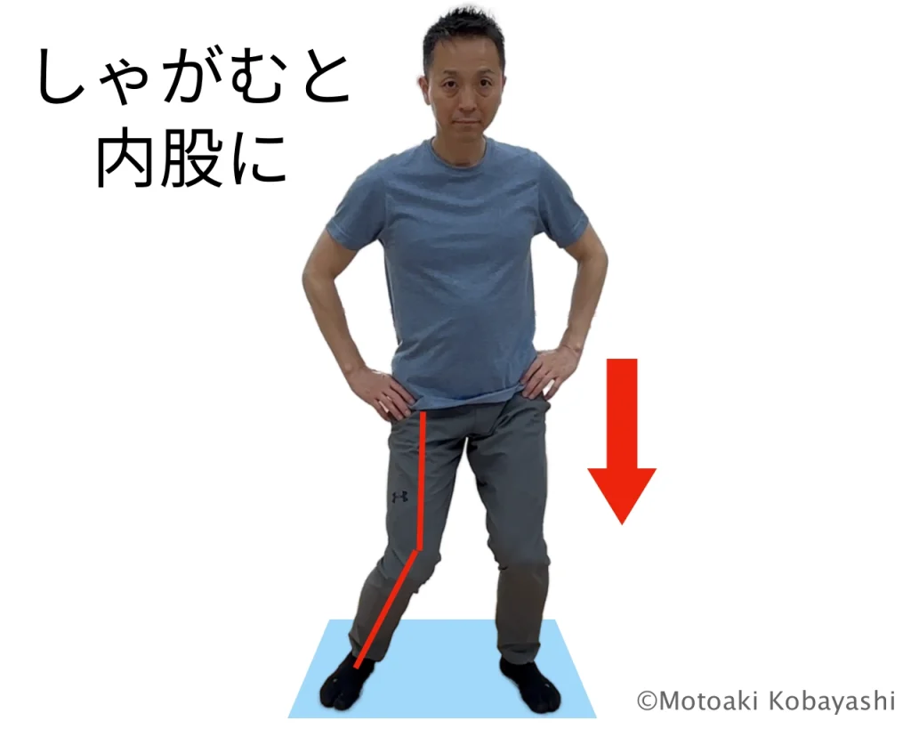 鵞足炎になりやすい人２